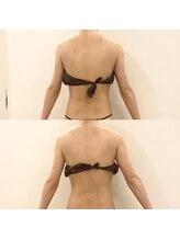 デンオブ(Den of)/【痩身ダイエット】WINBACK背中