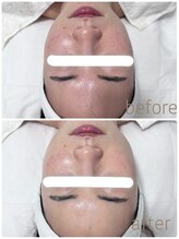 グレイス アンド ミューズ(grace&muse)/【クリスティーナ】アンストレス