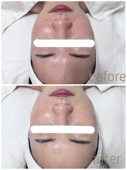 グレイス アンド ミューズ(grace&muse)/【クリスティーナ】アンストレス