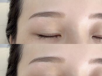 モア(Moi)/美眉wax脱毛