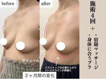 ソワ(soie)/出産・重力にも負けないバスト