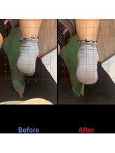 和鍼灸整骨院 イオン若松院/足関節調整2