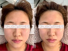 フレキシ 表参道(Flexi)/小顔矯正＋肩こり整体、骨盤矯正