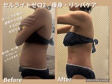 ボディリカバリー(Bodyリカバリー)/ビフォーアフター