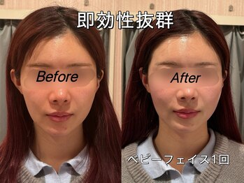 薬手名家 心斎橋店/お客様ビフォーアフター