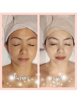 イーエムプレイス(EM;Place)/コラーゲン美肌フォト