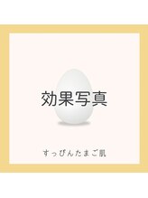 すっぴんたまご肌/