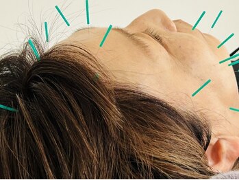 りんどう鍼灸院の写真/【首肩こり/腰/全身疲労に「鍼灸」という新しい選択肢】知る人ぞ知る[鍼灸施術]で利用者から喜びの声多数◎
