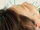 りんどう鍼灸院の写真/【首肩こり/腰/全身疲労に「鍼灸」という新しい選択肢】知る人ぞ知る[鍼灸施術]で利用者から喜びの声多数◎
