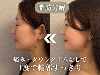 グランクウォーレ(Gran Cuore)の写真