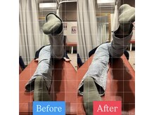 ナオル整体 宮崎院(NAORU整体)/20代女性施術事例【反り腰改善】