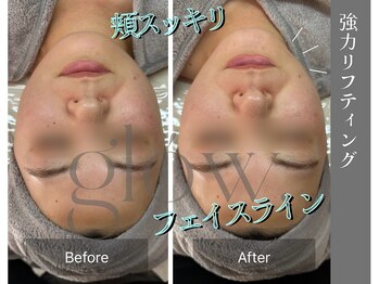 グロウ(glow.)/凝りも解せてリフトアップ！