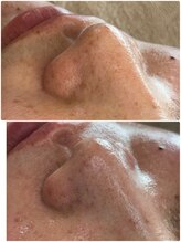 リノ(Lino)/鼻の黒ずみもしかして毛かも！