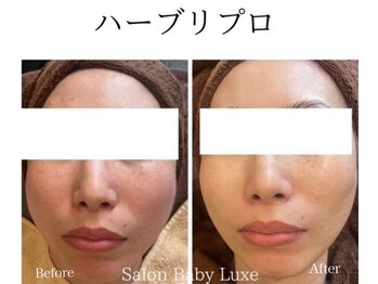 サロンベイビー 西宮本店(Salon Baby)/ハーブリプロ