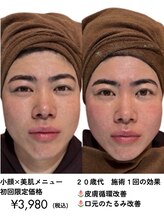 小顔美肌ファクトリー 金沢院/男性のお客様にもご好評！