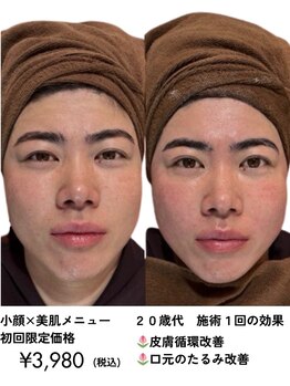 小顔美肌ファクトリー 金沢院/男性のお客様にもご好評！
