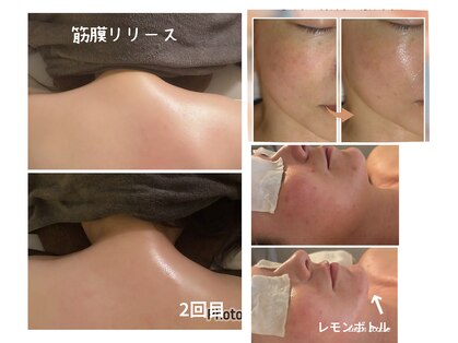 エンドット(EN.)の写真