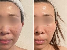 ひっそり美肌構築/お肌を綺麗に/肌管理プログラム