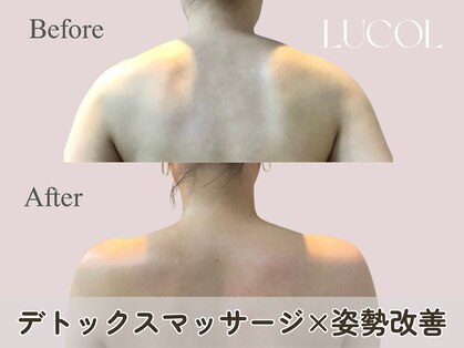 ルコル(LUCOL)の写真