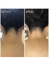 パーソナルエステティックサロン リボーン(ReBorn)/