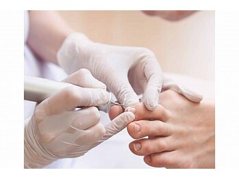 リゼラアンドコー 宇都宮店/巻き爪/肥厚爪、ネイルケア