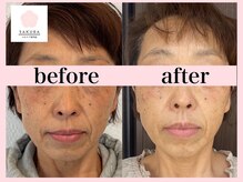 サクラ(SAKURA)/エアバリ効果