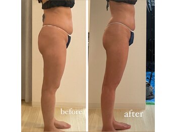 ジーニー(Genie)/お正月太りはすぐに意識！