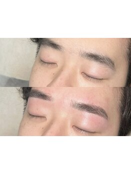 メンズフェイシャル