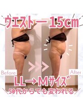 ビューティエン(beauty EN)/痩身ダイエットマッサージエステ