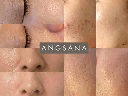 アンサナ 三軒茶屋(angsana)の写真