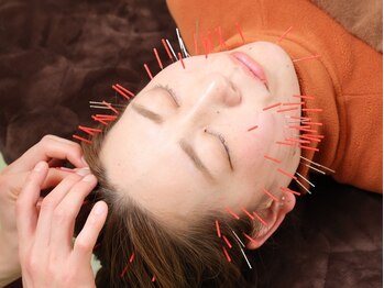谷町さくら鍼灸院/むくみやフェイスラインを美しく