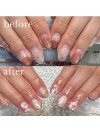 ウォーター角質ケア込み