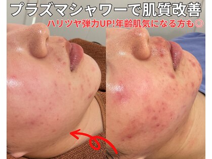 ベルファーム(Belle Femme)の写真