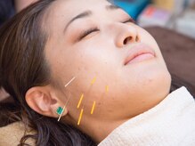 あおば鍼灸院接骨院 緑店/美容もできる整体院