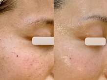 アン(An)の雰囲気（シミ、年齢が気になる肌悩みに【プラズマ肌質改善】）