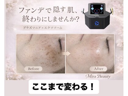 ミラビューティー(Mira Beauty)の写真