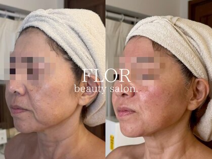 フロル(FLOR)の写真