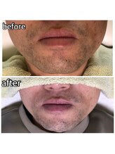 パーソナルエステティックサロン リボーン(ReBorn)/