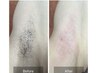 即ツルスベ実感☆【ワキwax +光脱毛】毎回男性¥3,500（女性¥3,300）