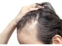 ヘアラボ(hairラボ)の雰囲気（男性の頭皮のお悩み・抜け毛・細毛の方もご相談下さい。）