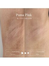 プリュベル(+belle)/◇ローマピンク - 脇 - ◇