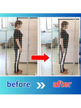 ストレッチヒーロー 倉吉店(STRETCH HERO)/立ち姿勢