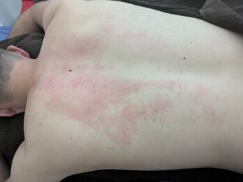 リデザイン 京都(REDESIGN)/REDESIGN京都中医施術法