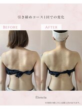 エレンシア(E'lencia)/施術効果（Before/After）