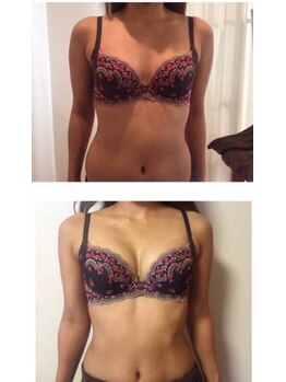 美人バスト 岡崎店/憧れの谷間がバストアップ