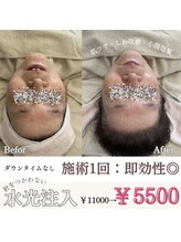 マヴィ 香里園店(MavY.)/ノンニードル水光注入