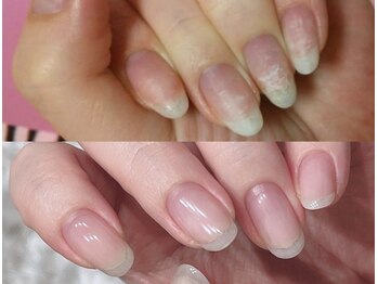 イズム(Izm)/約3ヶ月