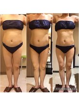 エステティック レイビス 銀座店(RAYVIS)/痩身効果写真