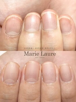 マリーロール 梅田店(Marie Laure)/深爪矯正/自爪育成/自爪風