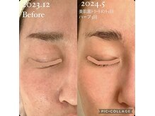 オレア(Olea)の雰囲気（初回の写真を見ると目を背けたくなる。今は楽しんで向き合えます）